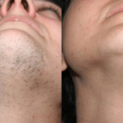 Passion Silk™ Hair Removal Cream