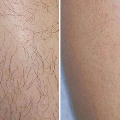 Passion Silk™ Hair Removal Cream