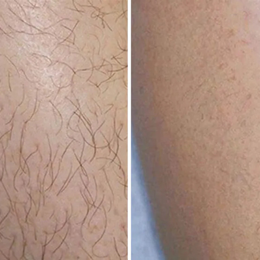 Passion Silk™ Hair Removal Cream