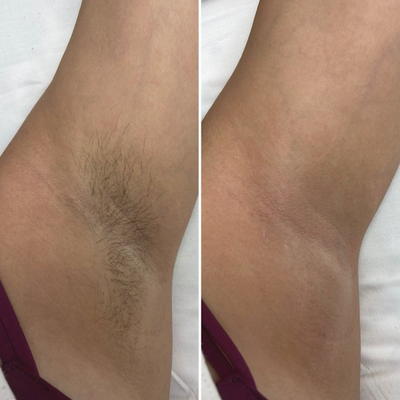 Passion Silk™ Hair Removal Cream